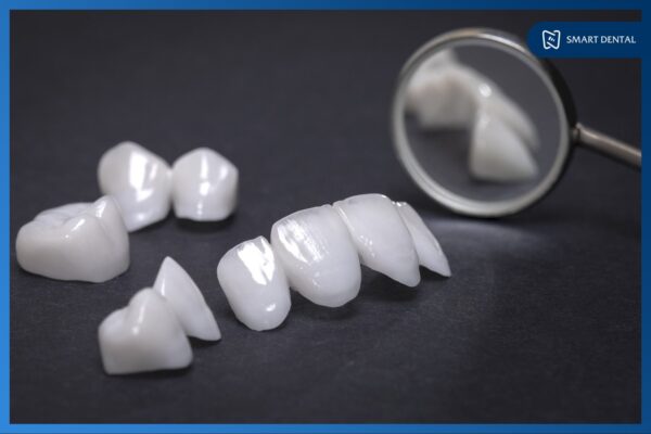 Bọc răng sứ cho răng cửa có nên không, có hiệu quả không? 5 Bọc răng sứ cho răng cửa có nên không, có hiệu quả không? 5