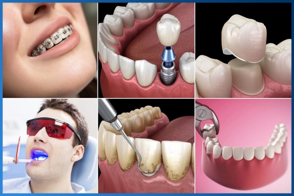 Răng số 8 bị sâu vỡ 7 Răng số 8 bị sâu vỡ 7