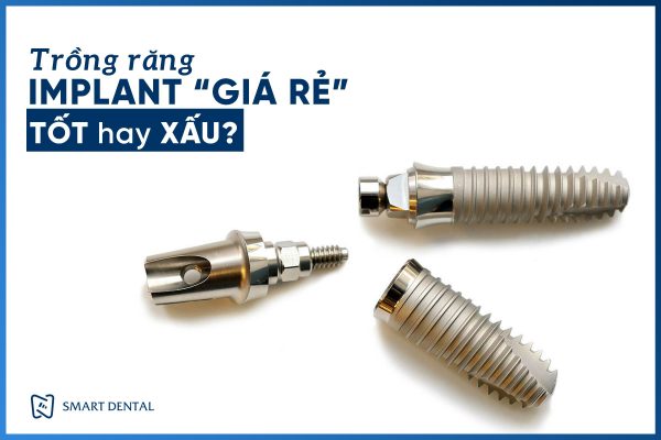 Trồng răng Implant giá rẻ 2