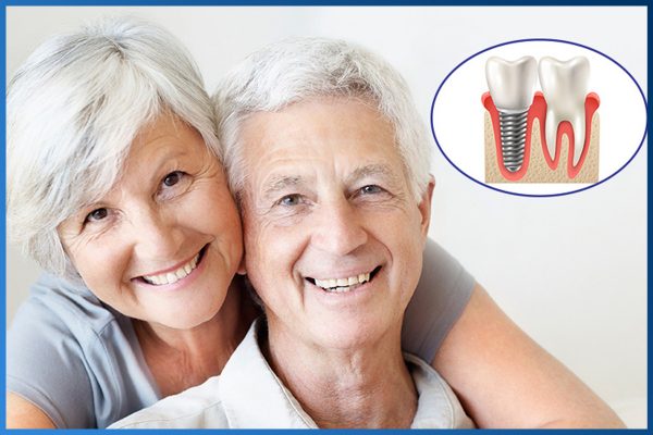 Trồng răng Implant nguyên hàm 4