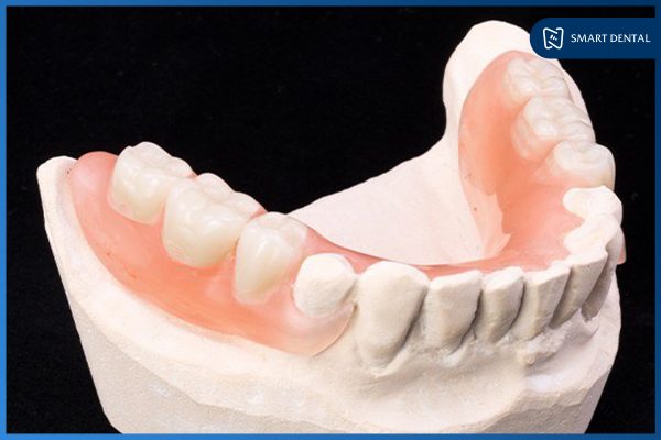 Trồng răng số 5 3 Trồng răng số 5 3