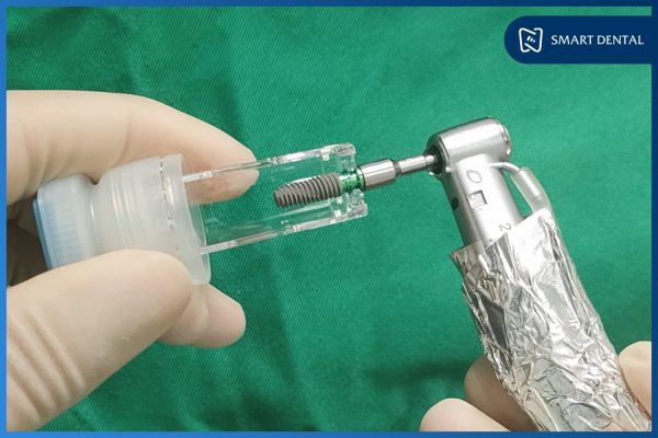 Trồng răng implant Hàn Quốc - Chi phí THẤP, chất lượng CAO! 2 Trồng răng implant Hàn Quốc - Chi phí THẤP, chất lượng CAO! 2