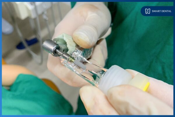 Khách hàng Trần Thùy Dương cấy 2 implant Hiossen Mỹ - Nha khoa Smart 5 Khách hàng Trần Thùy Dương cấy 2 implant Hiossen Mỹ - Nha khoa Smart 5