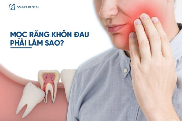Mọc răng khôn đau 3 Mọc răng khôn đau 3