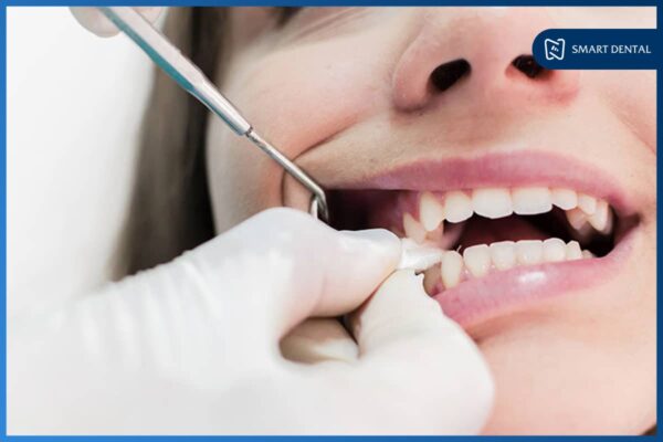 Nhổ răng khôn xong nên ăn gì 8 Nhổ răng khôn xong nên ăn gì 8