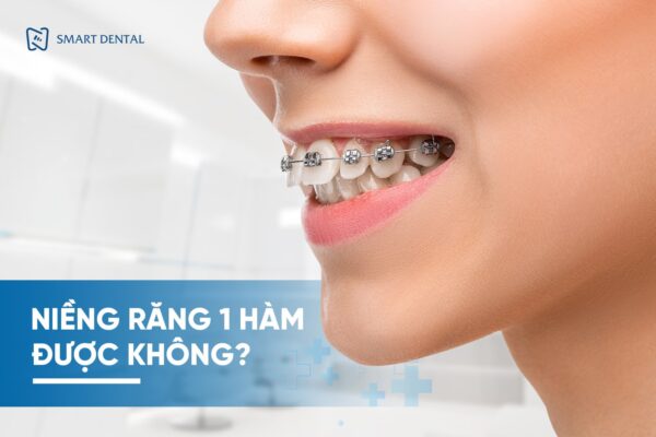 Niềng răng 1 hàm 1 Niềng răng 1 hàm 1