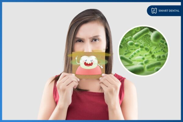 Hôi miệng 2 Hôi miệng 2