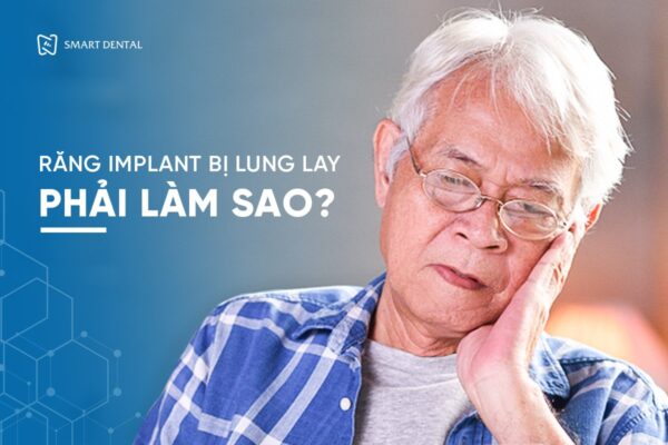 Răng Implant bị lung lay phải làm sao? Cách khắc phục nào hiệu quả? 1 Răng Implant bị lung lay phải làm sao? Cách khắc phục nào hiệu quả? 1