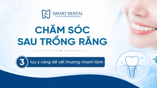 Chăm sóc sau trồng răng 1